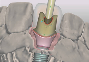 Meray Dental